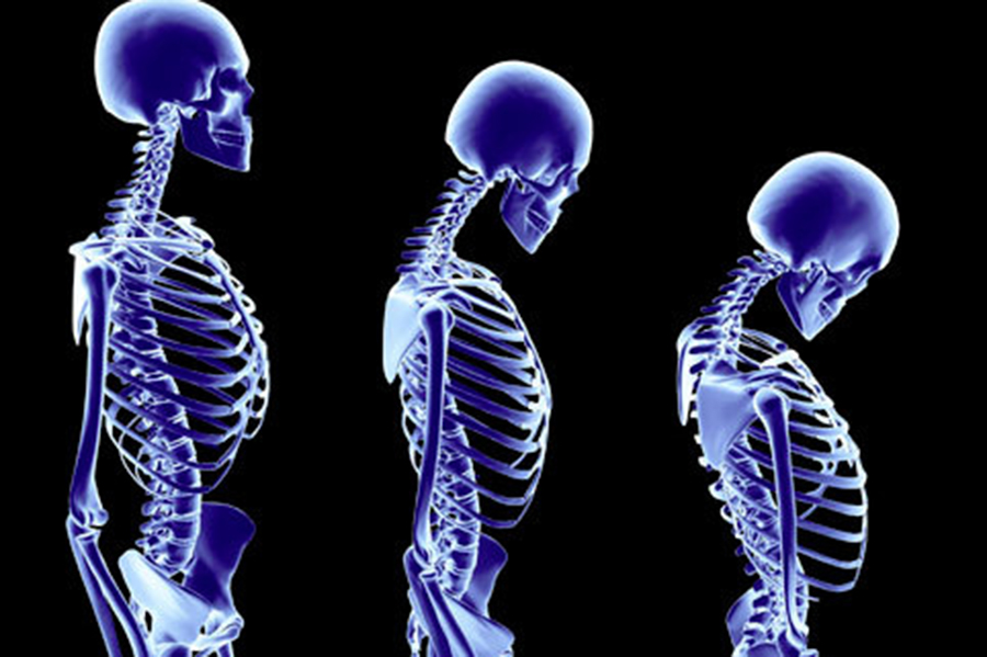 Cum să întârziați îmbătrânirea coloanei vertebrale